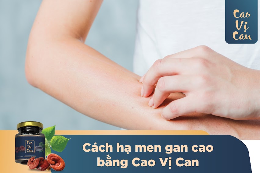 Cách hạ men gan bằng Cao Vị Can